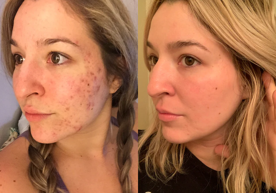 Sculpt Your Natural Beauty